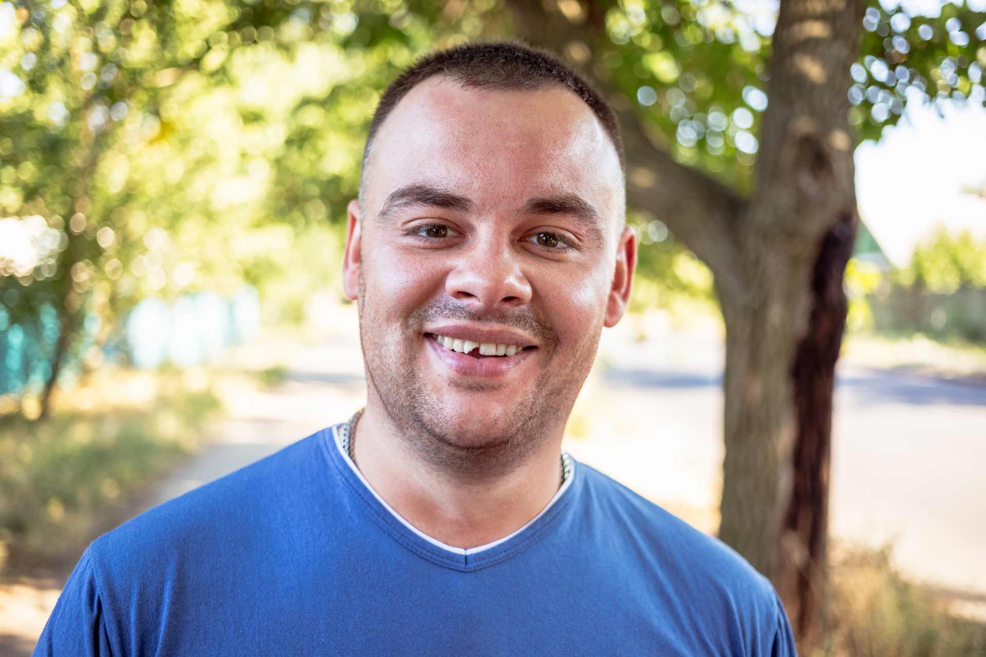 man-in-a-blue-T-shirt-with-a-chipped-tooth