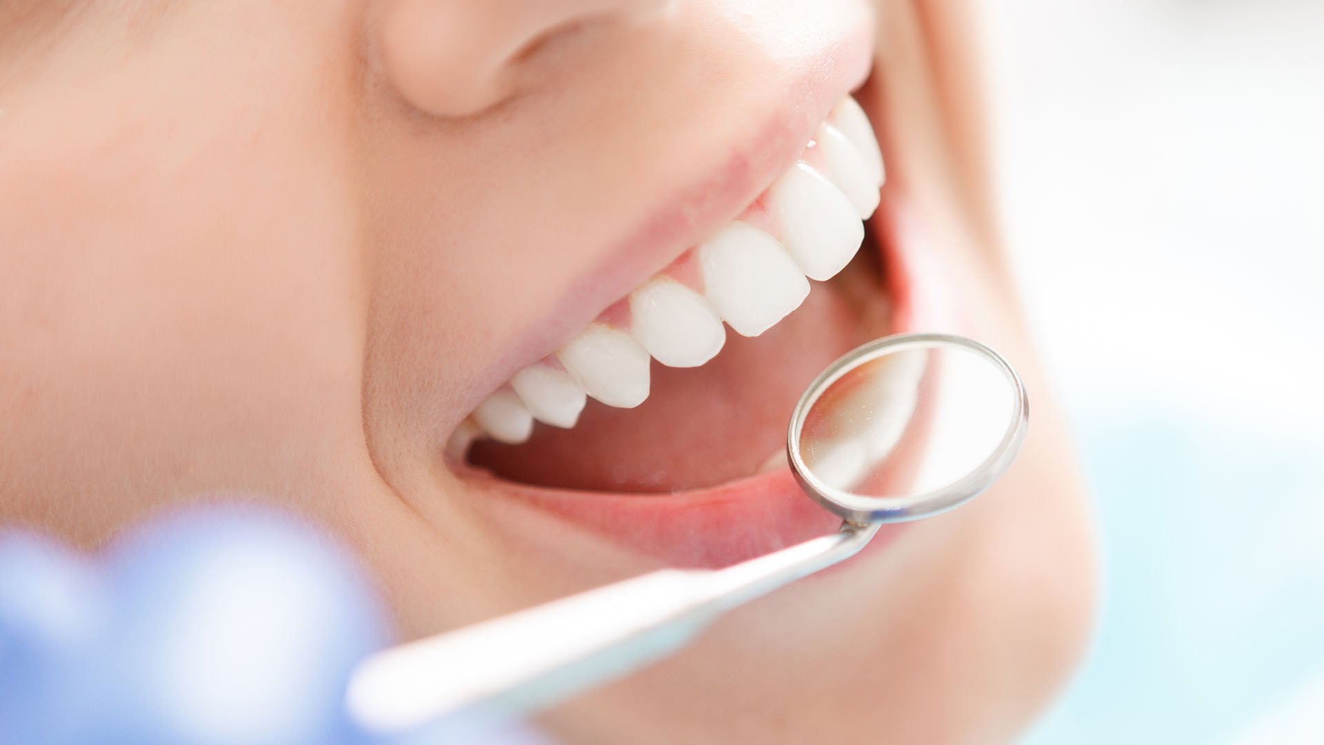 Close up shot of the mouth of woman with very white teeth getting examined 