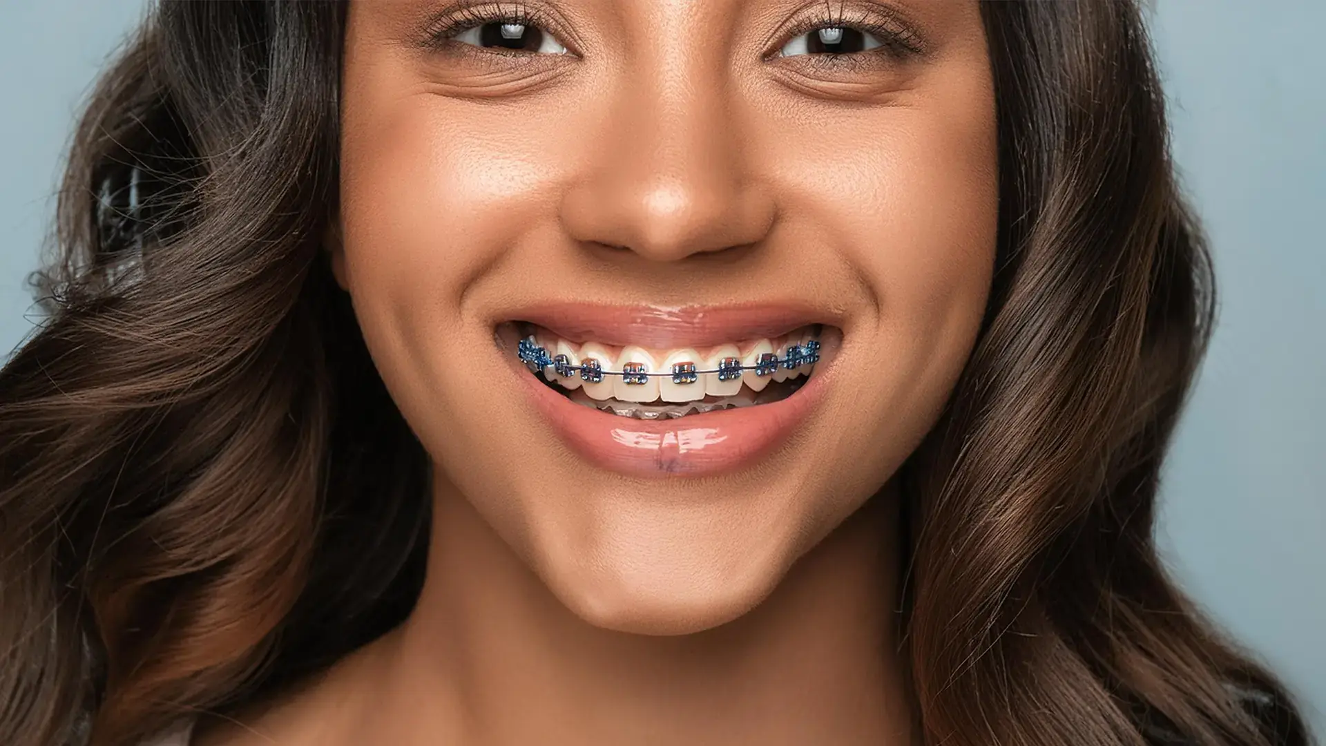 What Is a Crossbite? Signs, Effects, and Treatment