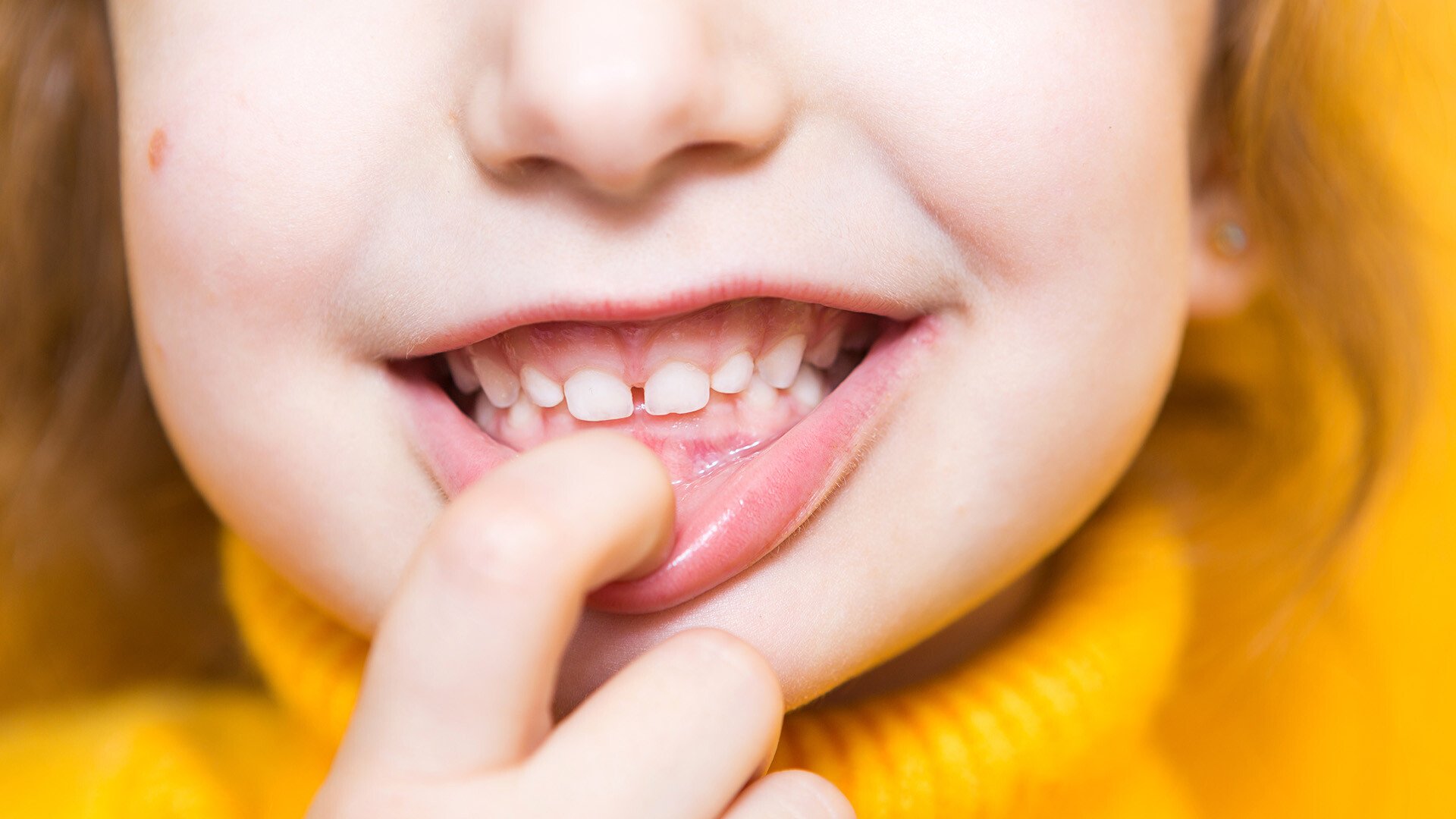 An up close shot a child in a yellow seater using their index finger to pull down their lower lip and show their teeth 