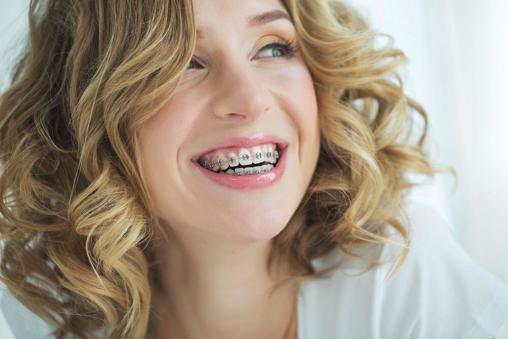 Malocclusion Explained: Causes, Symptoms, Treatment