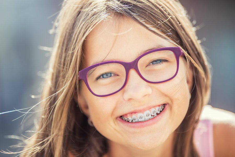 Braces 101: The Complete Guide to Braces