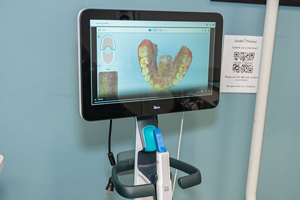 local-dentist-modern-dental-treatment-room_Gentle-Dental-Chula-Vista