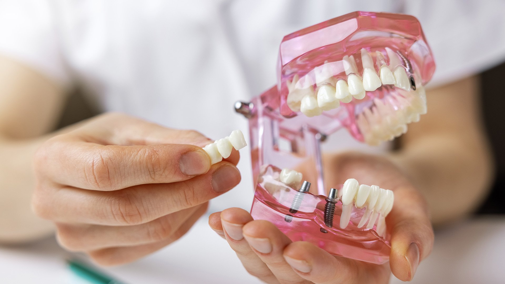 Close up model of a set of teeth held by a physician 