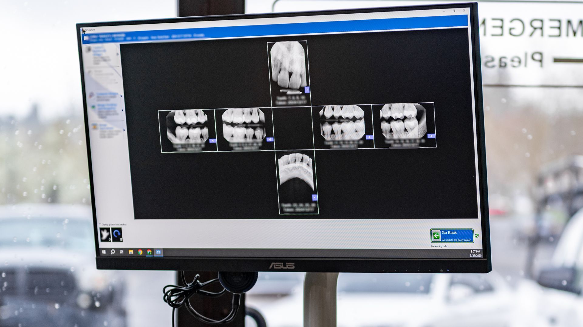 general-dentist-xray-action-shot_Gentle-Dental-Wood-Village